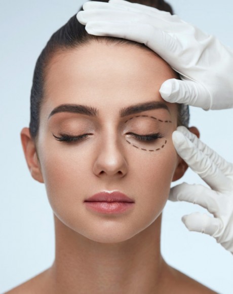 Consulta Blefaroplastia (Cirugía de párpados)