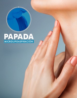 Consulta Lipo de papada