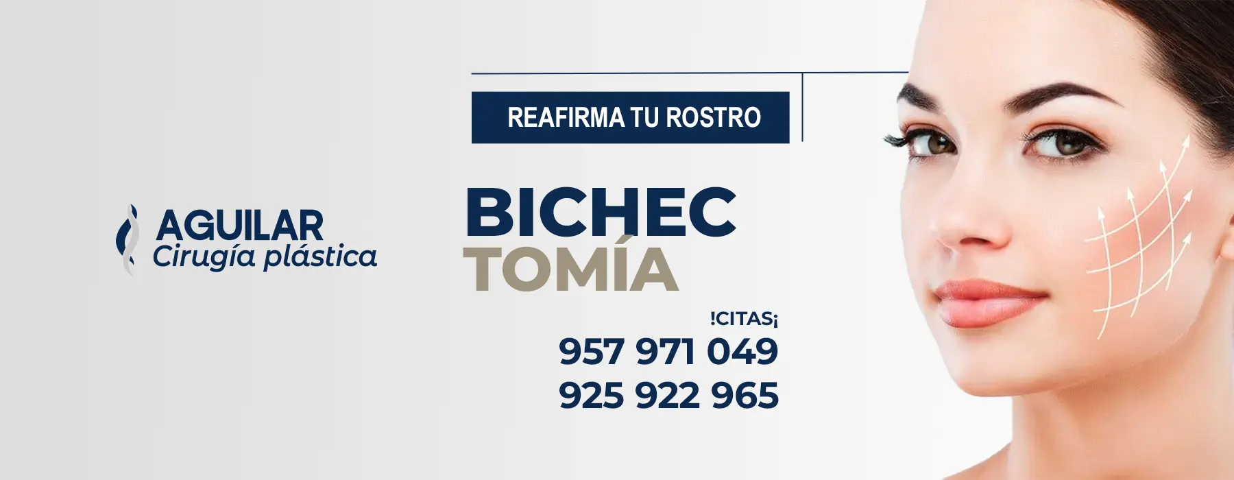 extracción de bolas de bichat en Lima