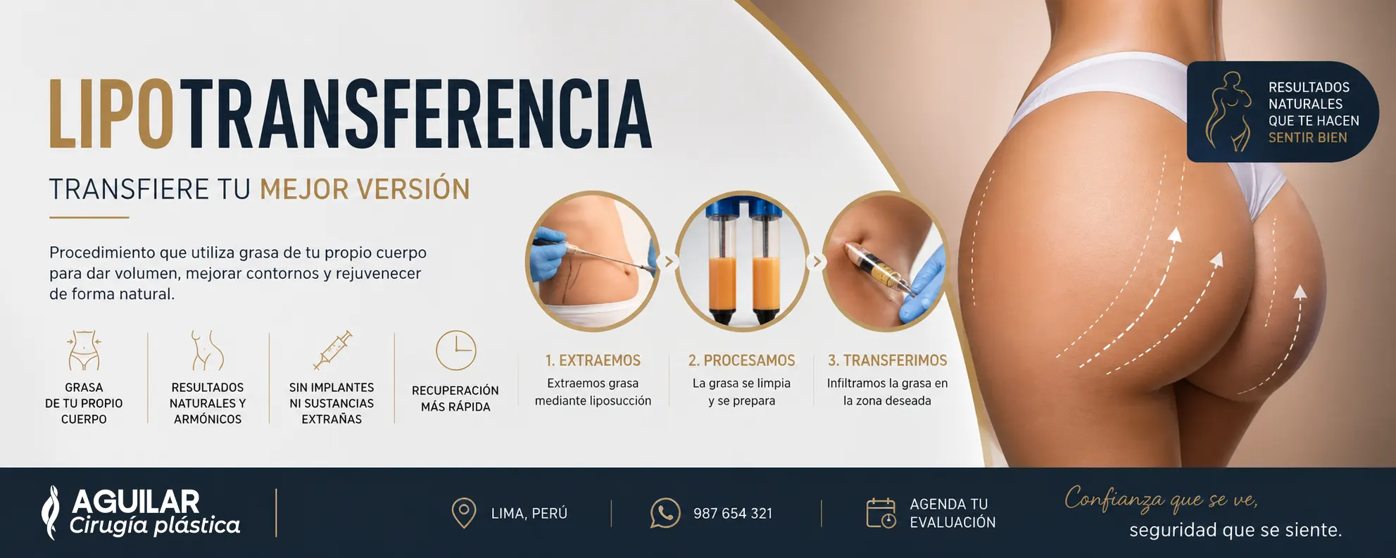 Procedimiento de transferencia de grasa en clínica estética de Lima