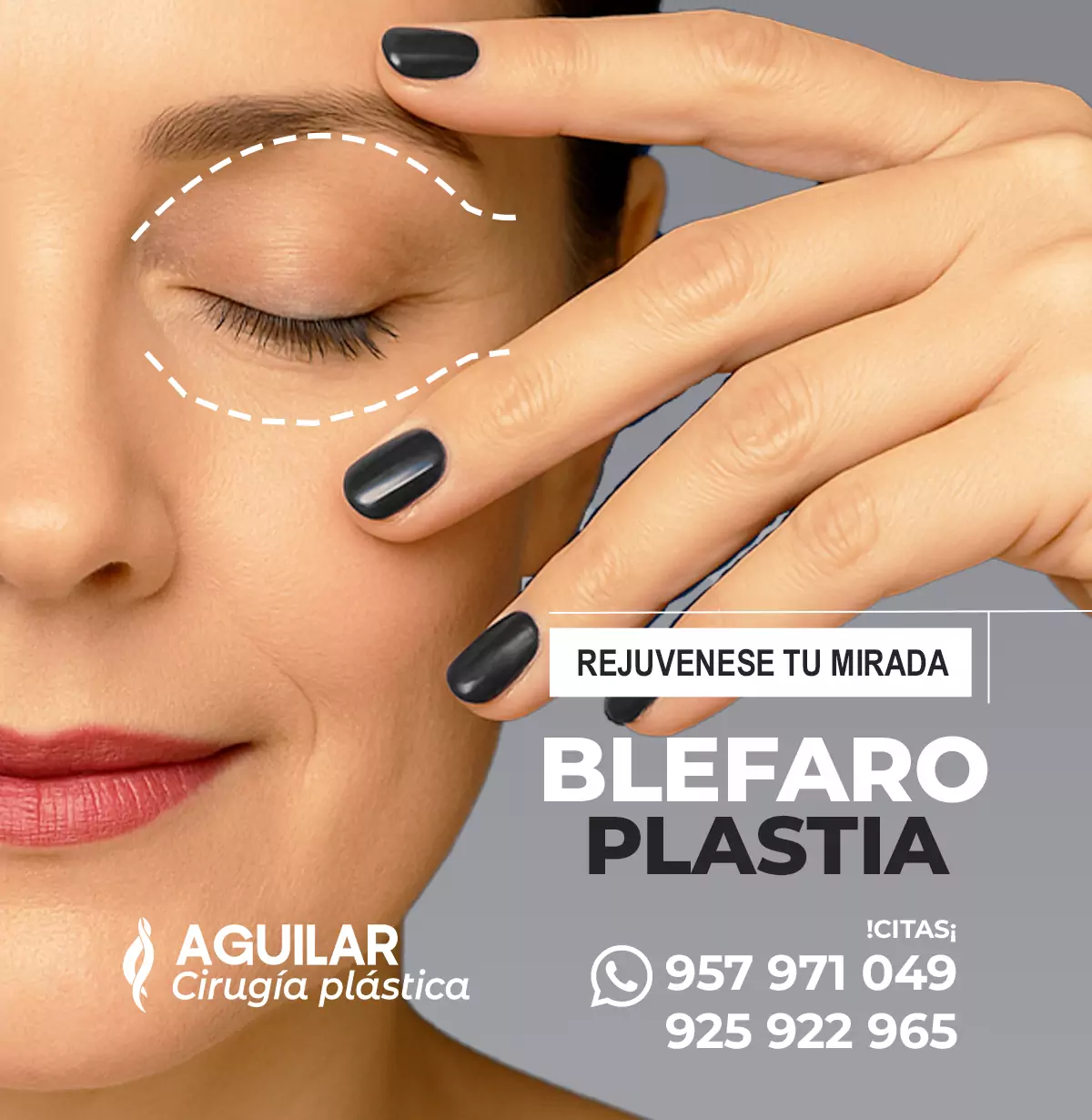 eliminación de bolsas en los ojos antes y después