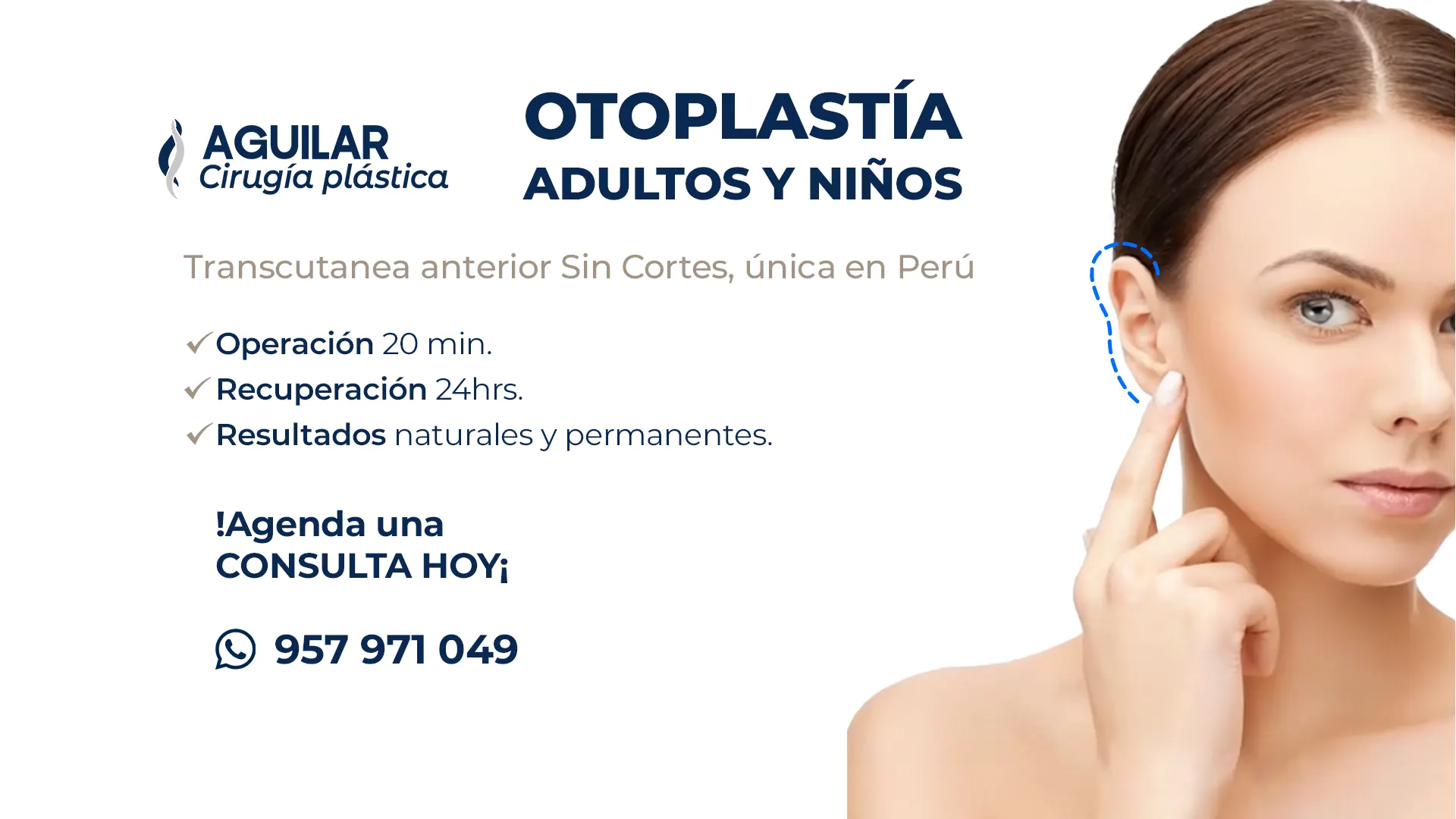 otoplastia en Lima antes y después