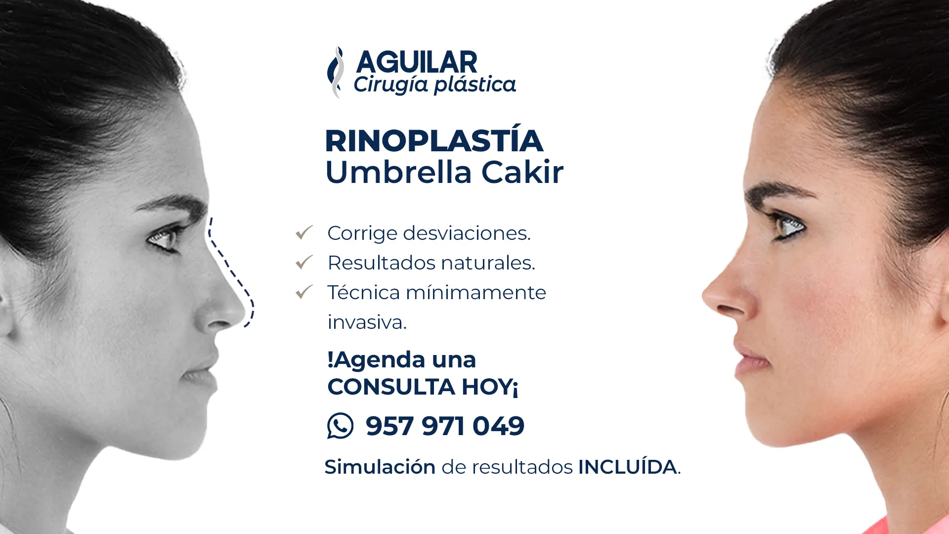 Rinoplastia moderna en Lima